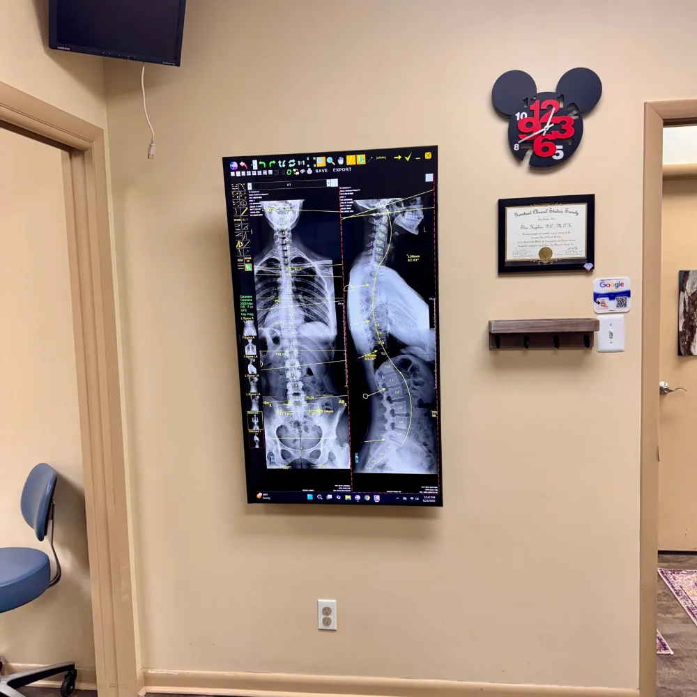 second chiropractic visit in glenside